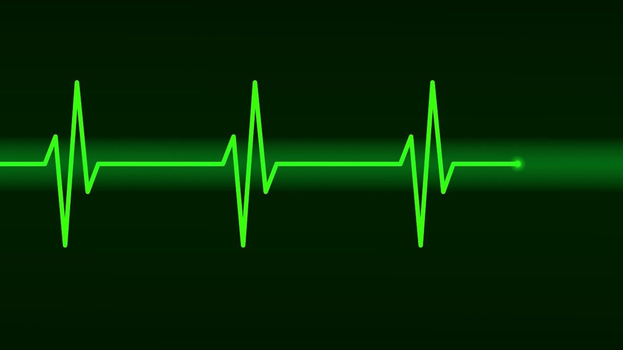 electrocardiogram, ecg, heartbeat, frequency, pulse, wave, computer graphics, signal, sine wave, hospital, health, green, black, electrocardiogram, ecg, ecg, ecg, ecg, ecg, heartbeat, heartbeat, heartbeat, pulse